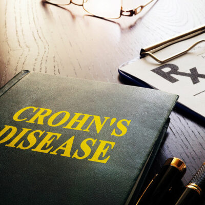 8 early warning signs of Crohn’s that shouldn’t be ignored